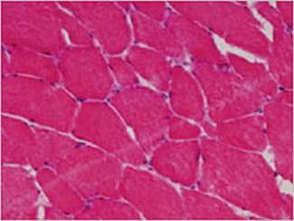 clin-ess-treated