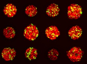 Cancer Spheroids, Image Courtesy of Molecular Devices