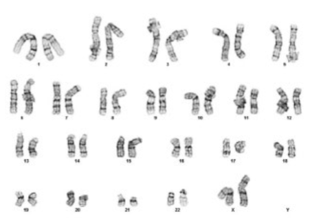 Figure 4. Karyotype of hiPSCs after 10 passages on Corning PureCoat rLaminin-521 cultureware.