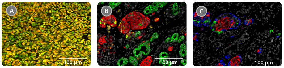 Generate Functional Pancreatic Progenitor Cells that Mature into Endocrine and Exocrine Cells