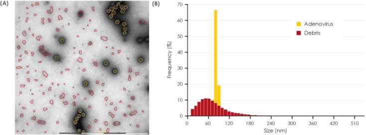 Figure 4 Image of Sample 2 illustrating the abundance of debris.