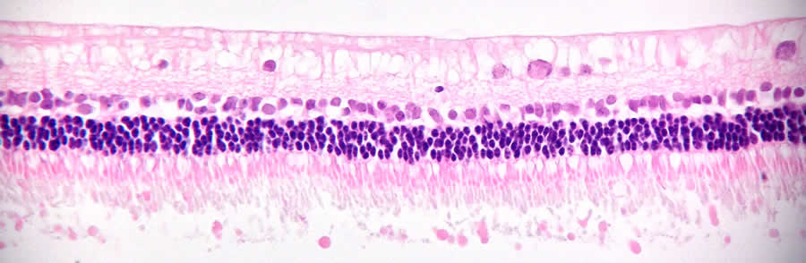 Fig7 Neuroretina BioLamina