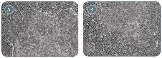 ReproTeSR™ Generates iPS Cell Colonies With Superior Colony Morphology