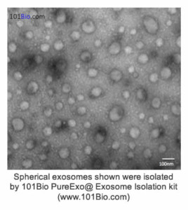 Spherical exosomes shown were isolated by 101Bio PureExo@ Exosome Isolation kit (www.101Bio.com) Spherical exosomes shown were isolated by 101Bio PureExo@ Exosome Isolation kit (www.101Bio.com)