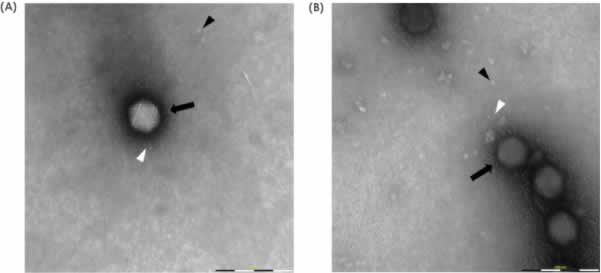 Figure 1 High-quality images of high magnifications of the two samples.