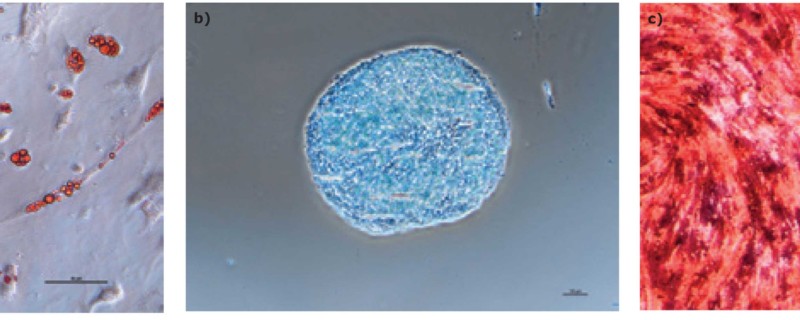 Cell Therapies Require Well defined Optimized Media