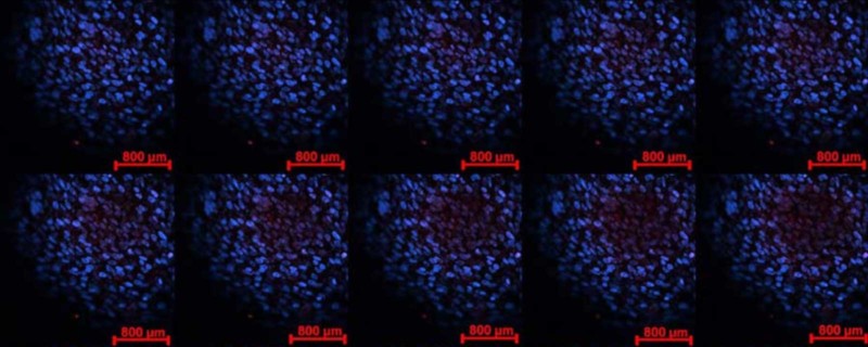 Evolution of Cell Therapy Manufacturing